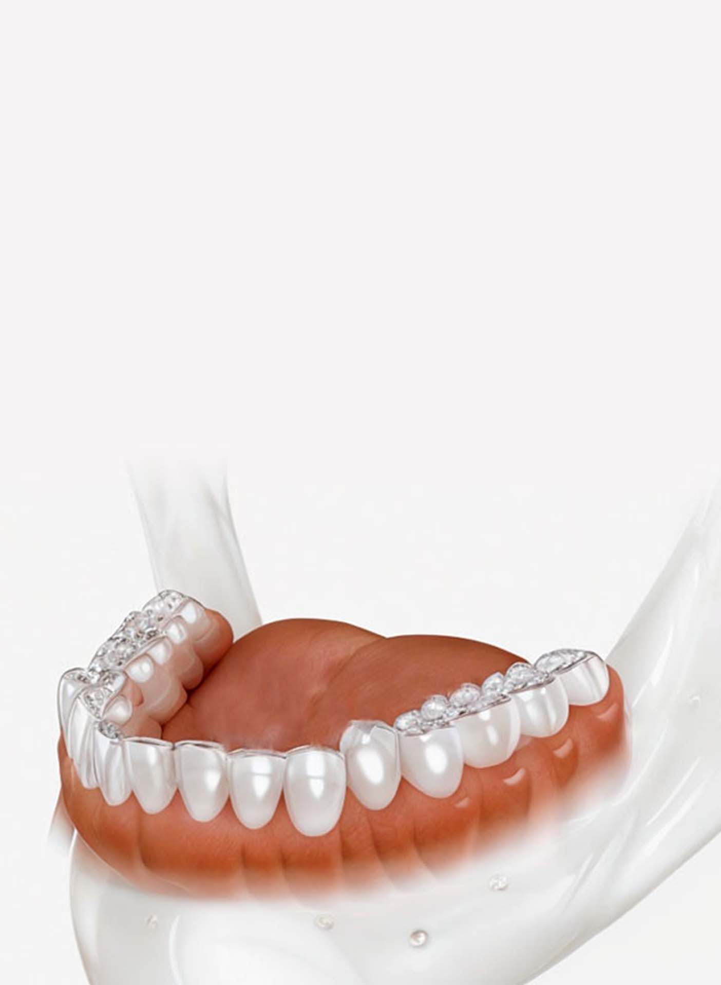 Clear aligners